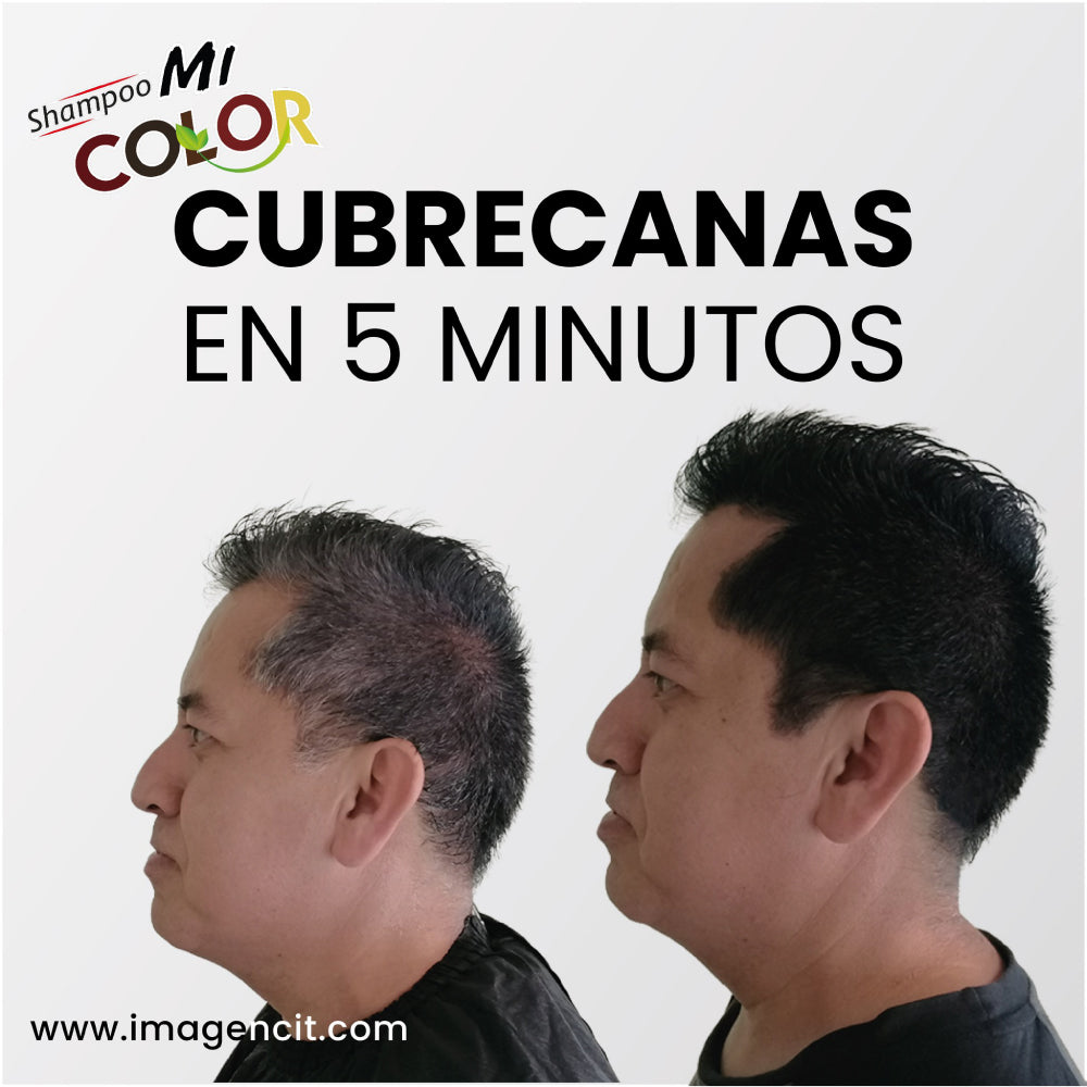 Shampoo Cubre Canas Imagencit